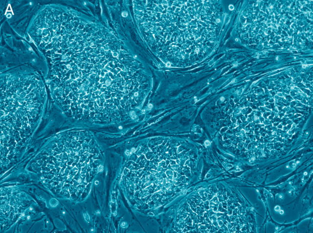 prop-14-stem-cell-research-cc-by-2-5